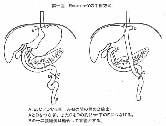 第一図