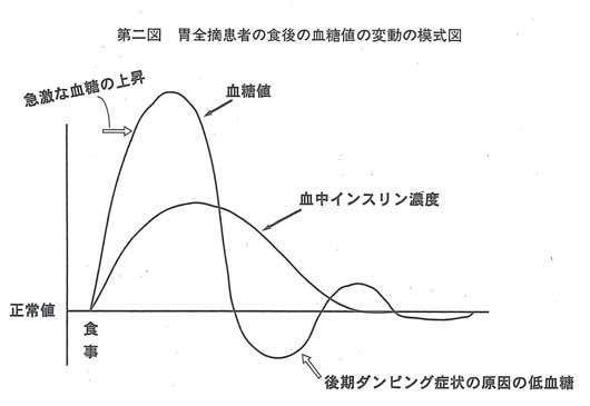 第二図